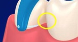 糸を歯と歯の間にスッと入れる