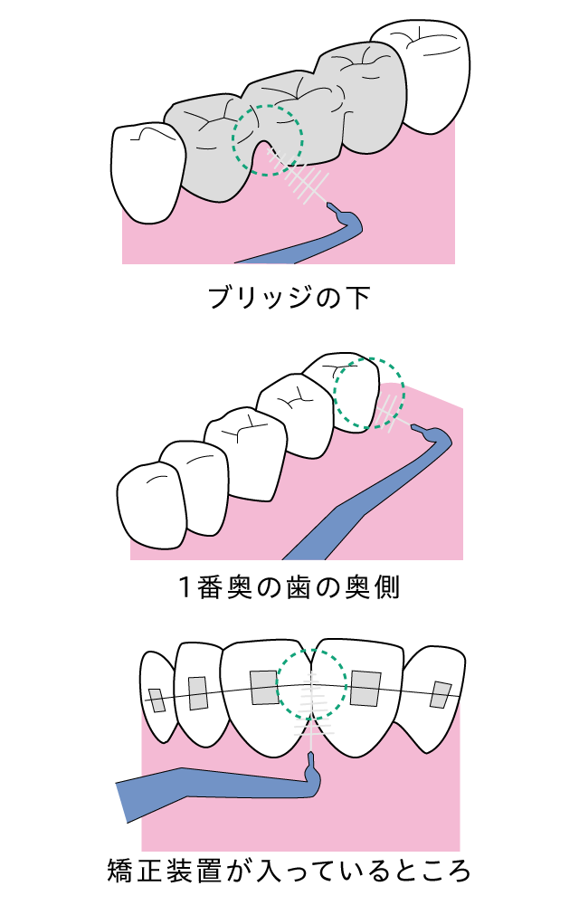 その他の「使用箇所」は?