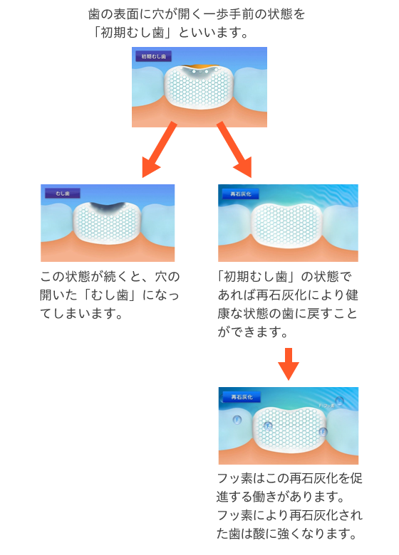 フッ素の働き