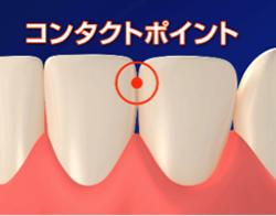 力まかせに挿入しない