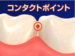 力まかせに挿入しない