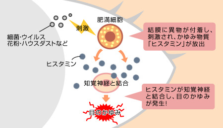 目のかゆみが起こる「メカニズム」