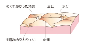 乾燥肌の「状態」
