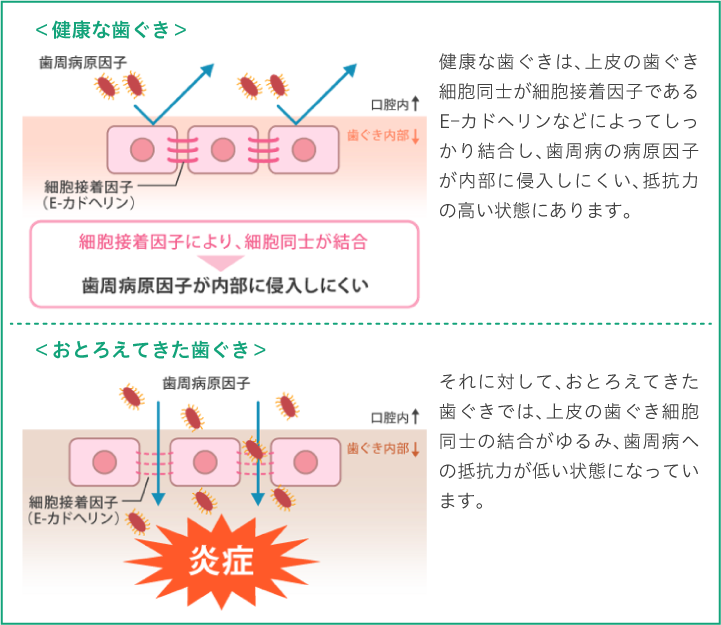 健康な歯ぐき/おとろえてきた歯ぐき