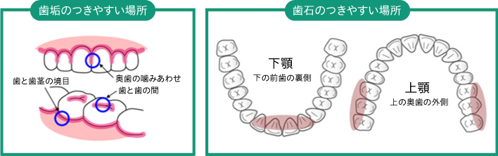 「汚れのつきやすい部分」は特に注意してみがく