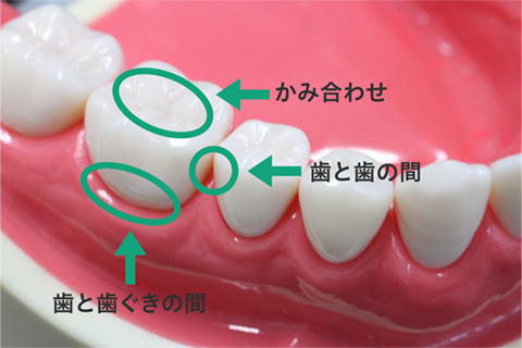 歯と歯の間・歯と歯ぐきの境目・かみ合わせ