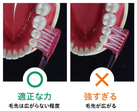 歯垢は毛先が広がらない程度の「軽い力」で落とせる
